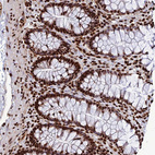 Anti-INO80E Antibody