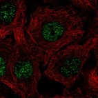 Anti-C17orf50 Antibody