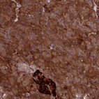 Anti-DDX60L Antibody