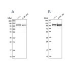 Anti-RBM12 Antibody