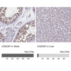 Anti-CCDC97 Antibody