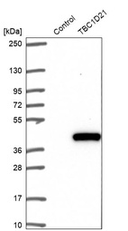 Anti-TBC1D21 Antibody