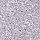 Anti-CCDC97 Antibody