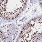 Anti-CCDC97 Antibody