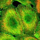 Anti-CCDC97 Antibody