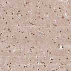 Anti-KCTD13 Antibody