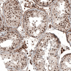 Anti-KCTD13 Antibody