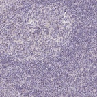 Anti-FAHD1 Antibody