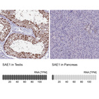 Anti-SAE1 Antibody