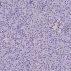 Anti-SAE1 Antibody