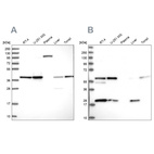 Anti-SAE1 Antibody