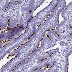 Immunohistochemical staining of human fallopian tube shows strong positivity in cilia of glandular cells.