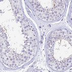 Immunohistochemical staining of human testis shows moderate positivity in flagellum of spermatozoa.