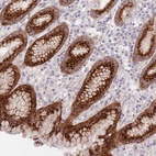 Anti-BORCS5 Antibody