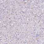 Immunohistochemical staining of human liver shows low expression as expected.