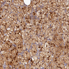 Anti-SPATA5L1 Antibody