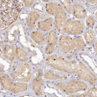 Anti-SPATA5L1 Antibody