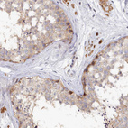 Anti-SPATA5L1 Antibody