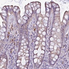 Anti-NAT1 Antibody