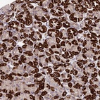 Anti-MGAT2 Antibody