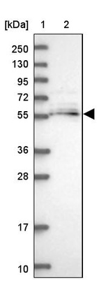 Anti-MGAT2 Antibody