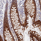 Anti-TMEM44 Antibody