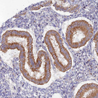 Anti-TMEM44 Antibody