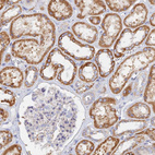 Anti-TMEM44 Antibody