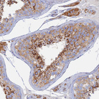 Anti-TMEM44 Antibody