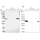 Anti-LPXN Antibody