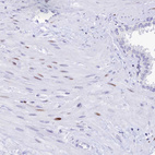 Immunohistochemical staining of human prostate shows weak nuclear positivity in smooth muscle cells.