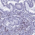 Immunohistochemical staining of human endometrium shows moderate nuclear positivity in stromal cells.