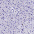 Anti-PRPS1 Antibody