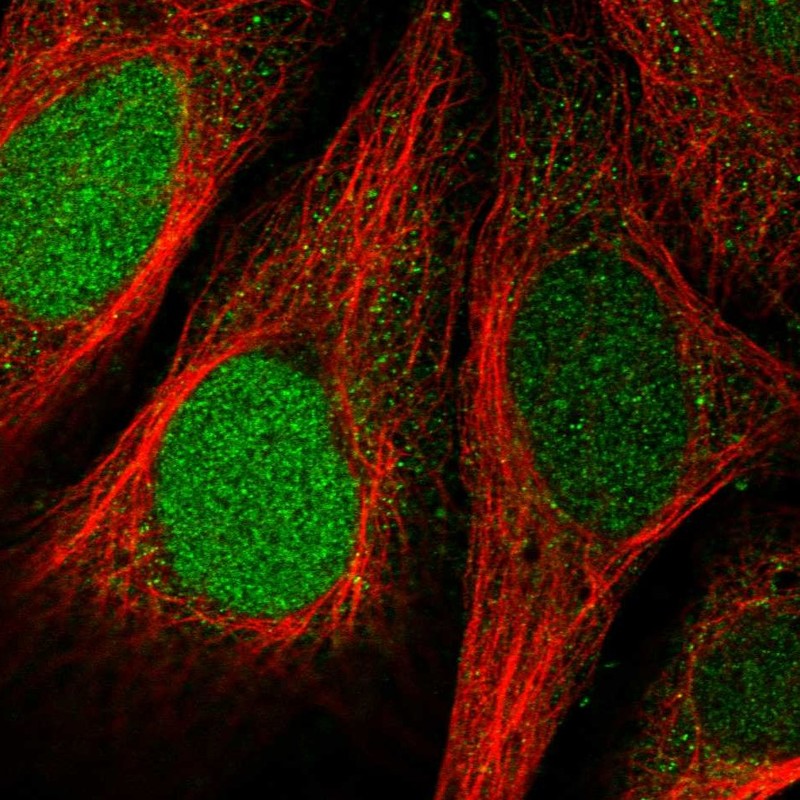 Anti-FAM64A Antibody