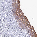 Anti-ZXDB Antibody