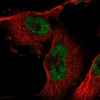 Immunofluorescent staining of human cell line U-251 MG shows localization to nucleoplasm.