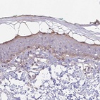 Immunohistochemical staining of human skin shows high expression.