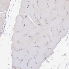 Immunohistochemical staining of human skeletal muscle shows low expression as expected.