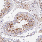 Anti-VSTM2L Antibody