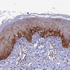 Anti-FASTKD5 Antibody