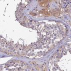 Anti-SLC39A13 Antibody