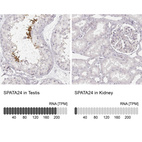 Anti-SPATA24 Antibody