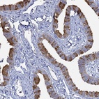 Anti-RABL2A Antibody