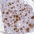 Anti-BPIFA2 Antibody