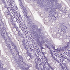 Immunohistochemical staining of human gastrointestinal shows no positivity in glandular cells as expected.