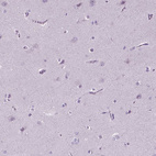 Immunohistochemical staining of human cerebral cortex shows no positivity in neuronal cells as expected.