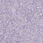 Anti-KIAA0408 Antibody