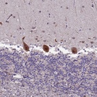 Anti-TROAP Antibody