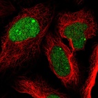 Immunofluorescent staining of human cell line U-2 OS shows localization to nucleoplasm & nuclear bodies.