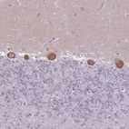 Anti-ZNF501 Antibody